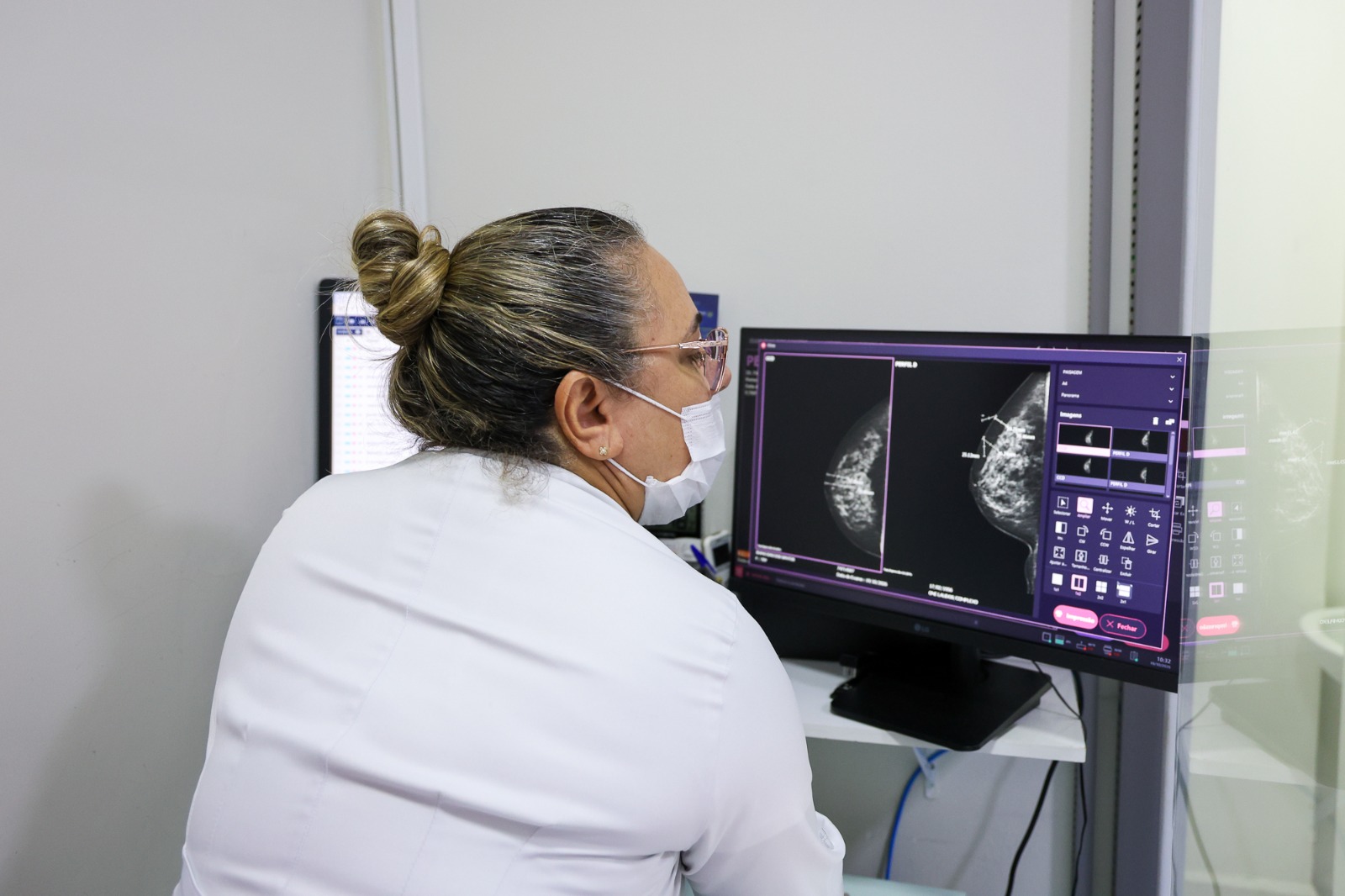 São Caetano inicia Mutirão de Mamografia com atendimentos por livre demanda no Complexo Hospitalar