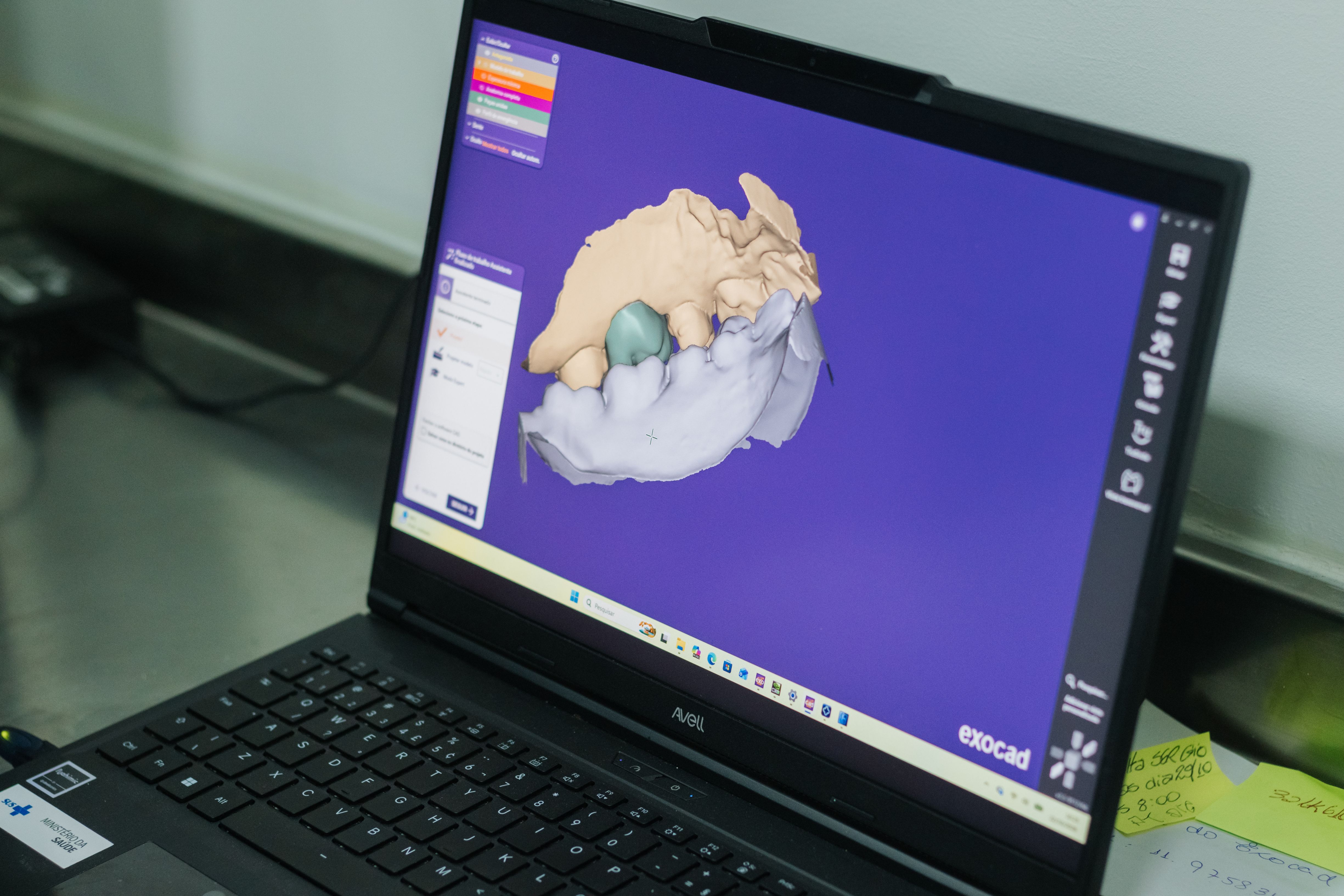 São Bernardo apresenta ao Ministério da Saúde modernização da saúde bucal com tecnologia 3D