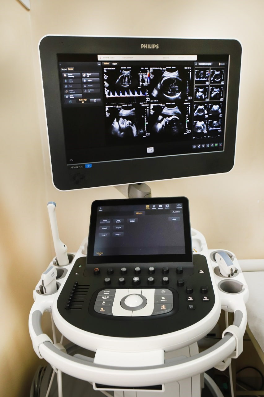 Diadema promove mutirão de ultrassom no próximo domingo (22)